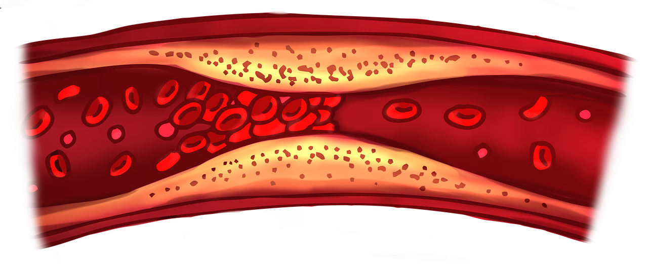 9-warning-signs-and-symptoms-of-dangerous-blood-clots-befit-ca